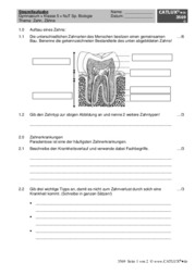 Stegreifaufgabe für das Fach Biologie am Gymnasium Thema Zahn, Zähne, Zahntypen, Paradentose